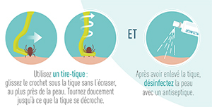 Utilisez un tire-tique pour en glissant le crochet sous la tique sans l'écraser. Tournez doucement jusqu’à ce que la tique se décroche. Ensuite désinfectez la peau avec un antiseptique. 