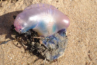 La physalie n'est pas une méduse : elle n'en reste pas moins très urticante. Elle est reconnaissable à sa couleur bleutée. Soyez vigilant !