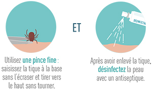 Si vous utilisez une pince fine pour enlever la tique : saisissez la tique à la base sans l'écraser et tirer vers le haut sans tourner. Ensuite, après avoir enlevé la tique, désinfectez la peau avec un antiseptique.